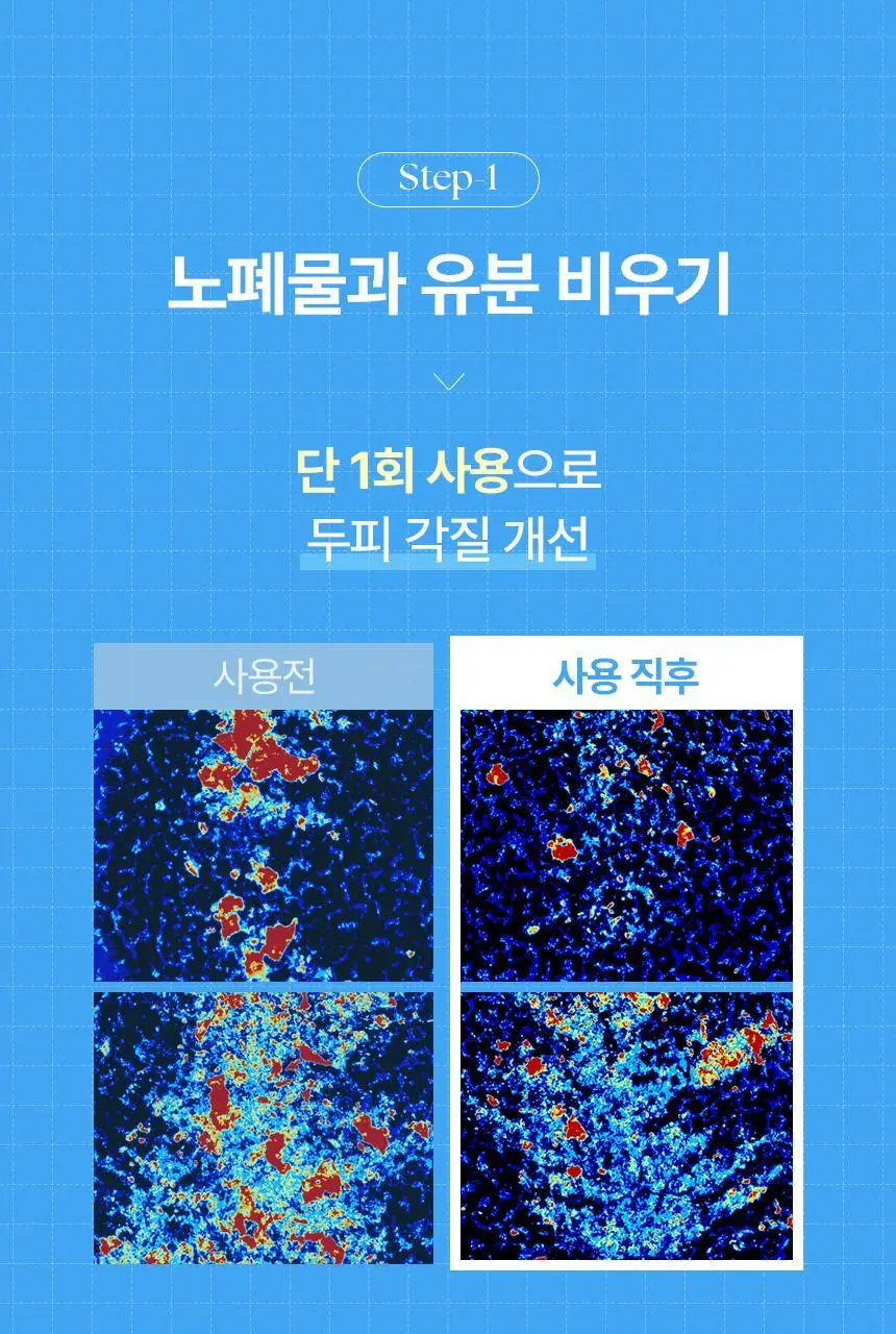 [뿌리볼륨UP] 쿤달 히알루론 두피케어 볼륨 샴푸 500ml 블라썸 브리즈 단독기획세트 상세페이지 14